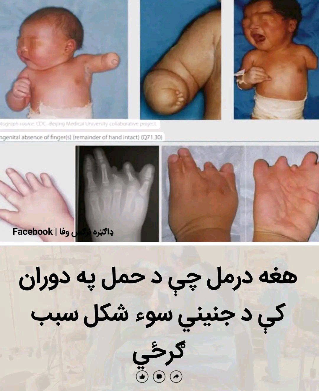 ریس خادیم