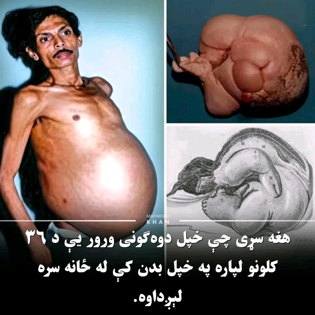 ریس خادیم