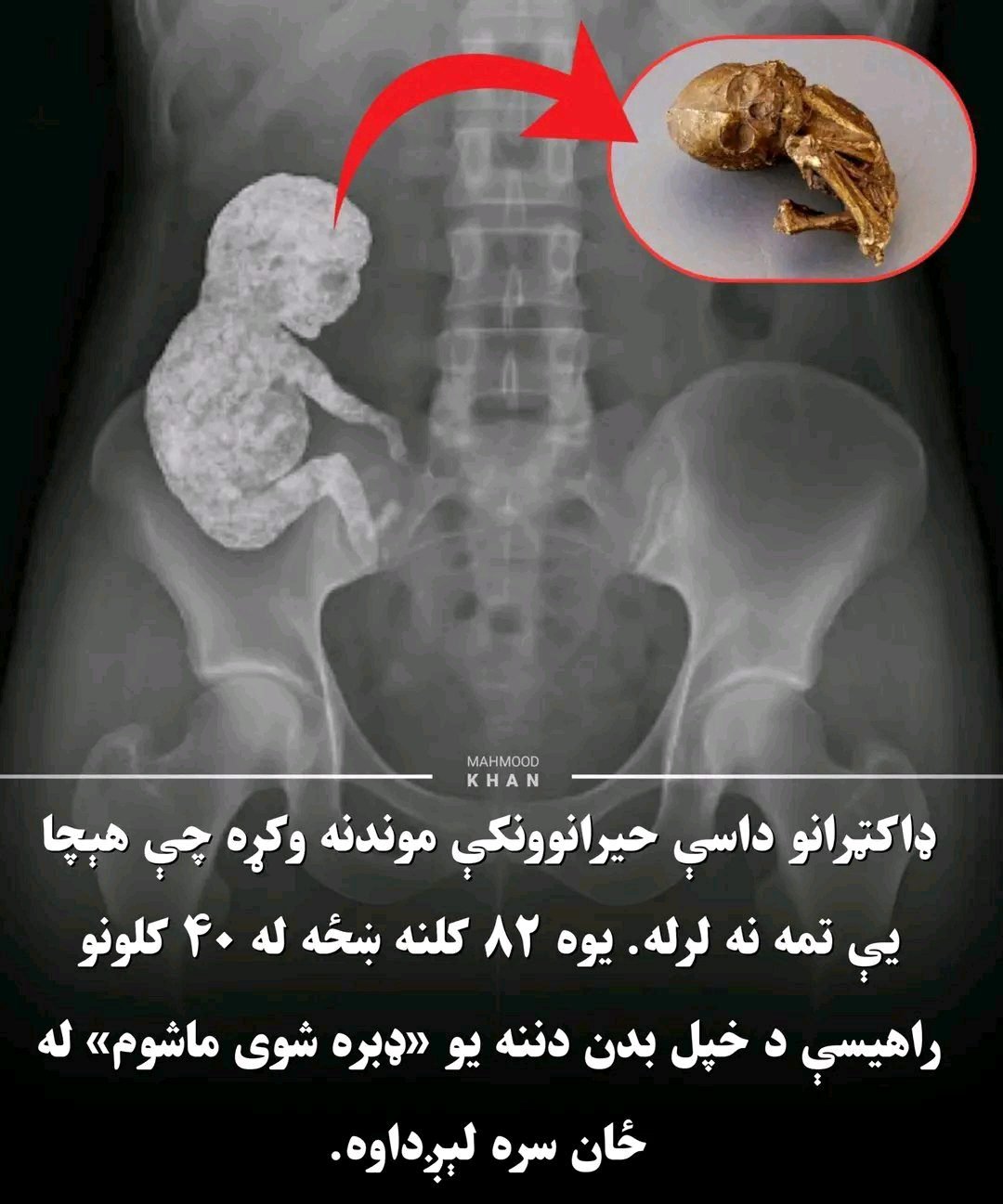ریس خادیم