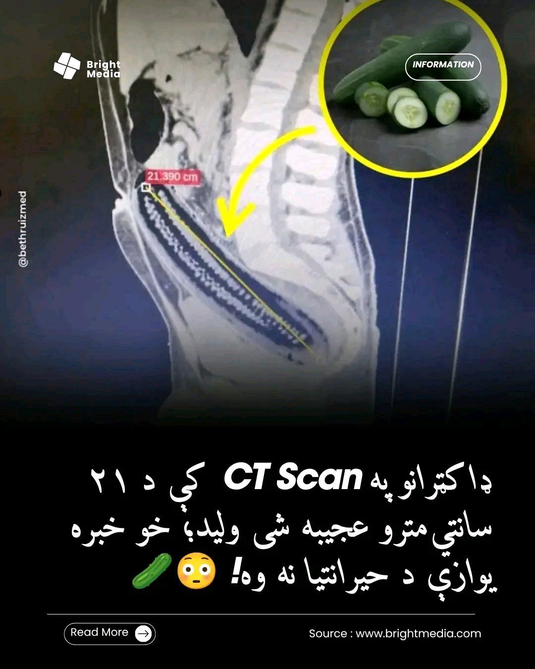 ریس خادیم