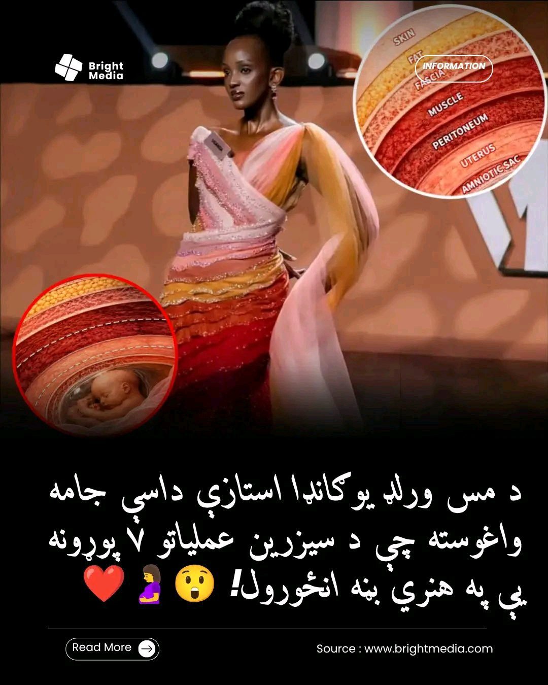 ریس خادیم