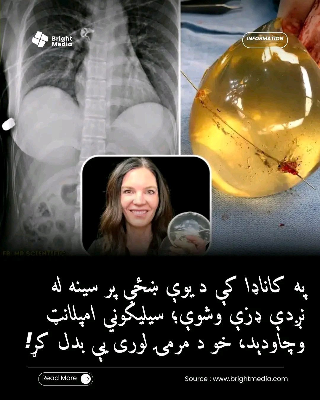 ریس خادیم