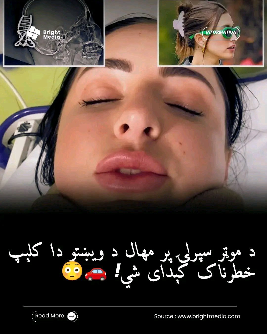 ریس خادیم