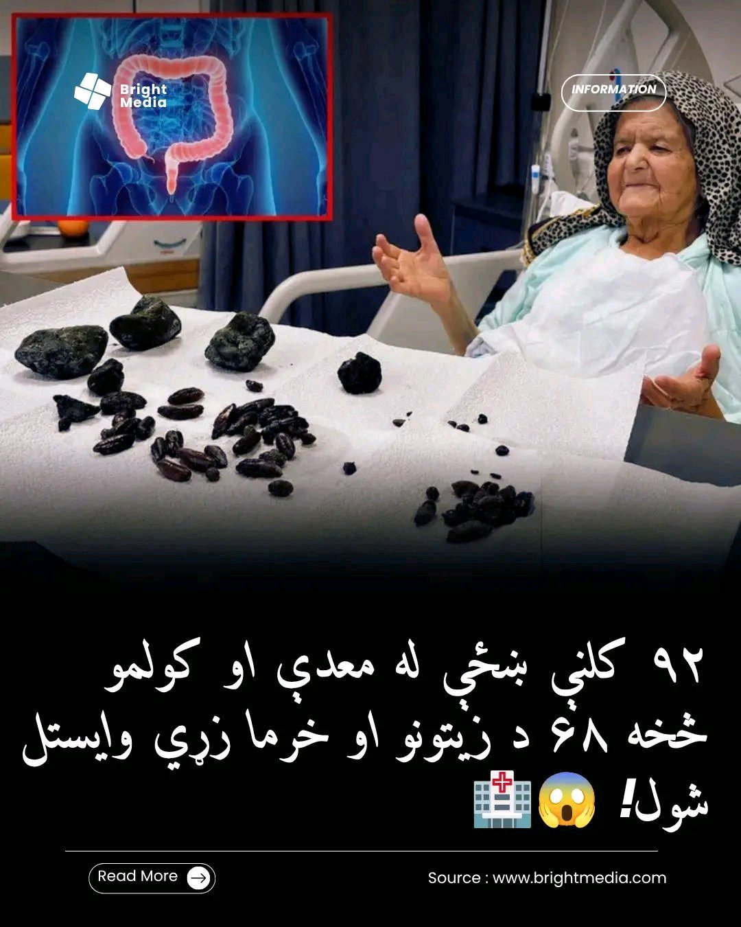 ریس خادیم