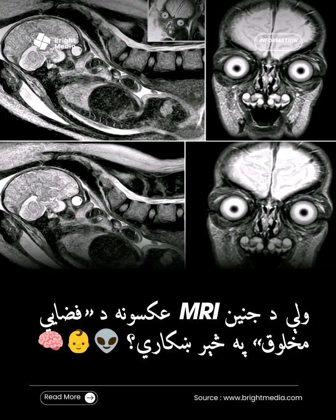 ریس خادیم