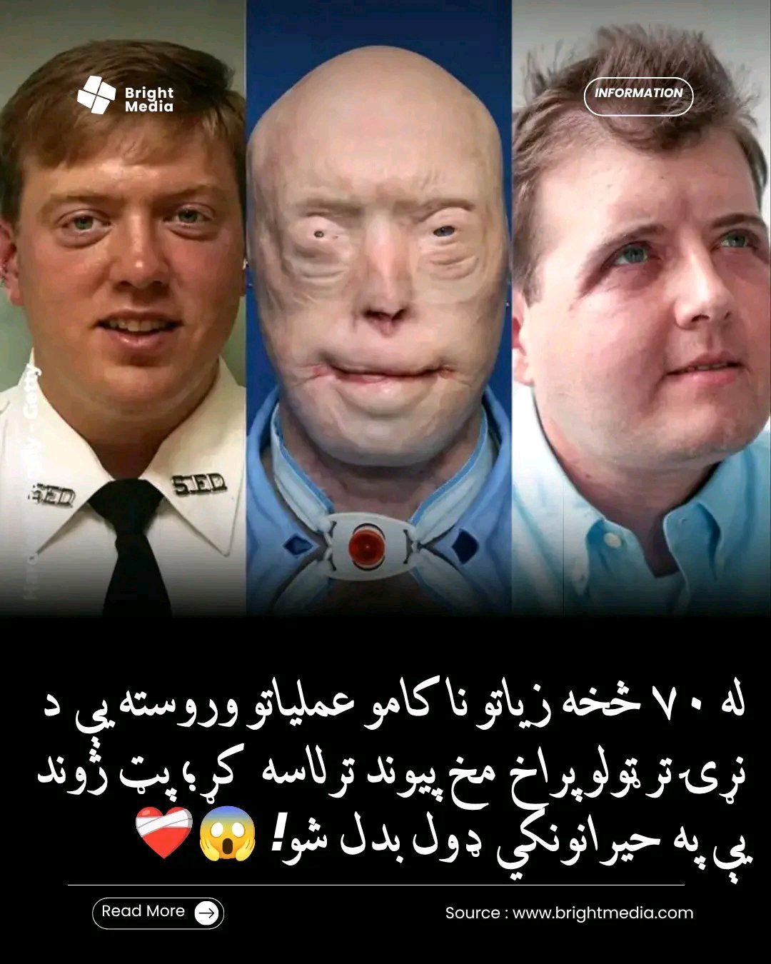 ریس خادیم