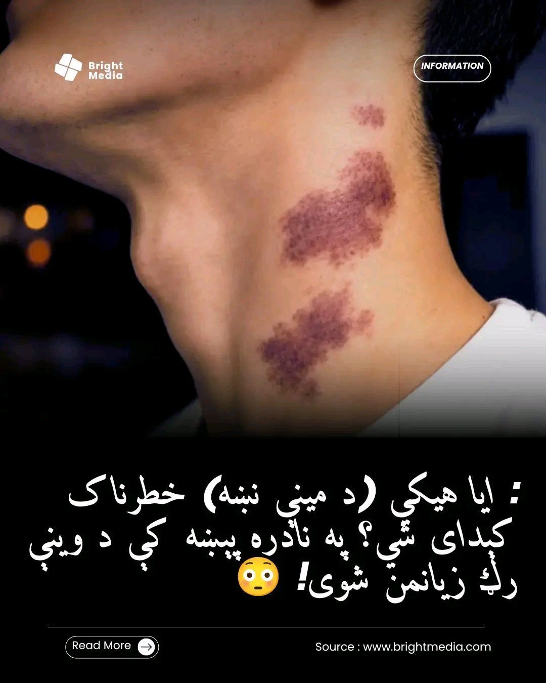 ریس خادیم
