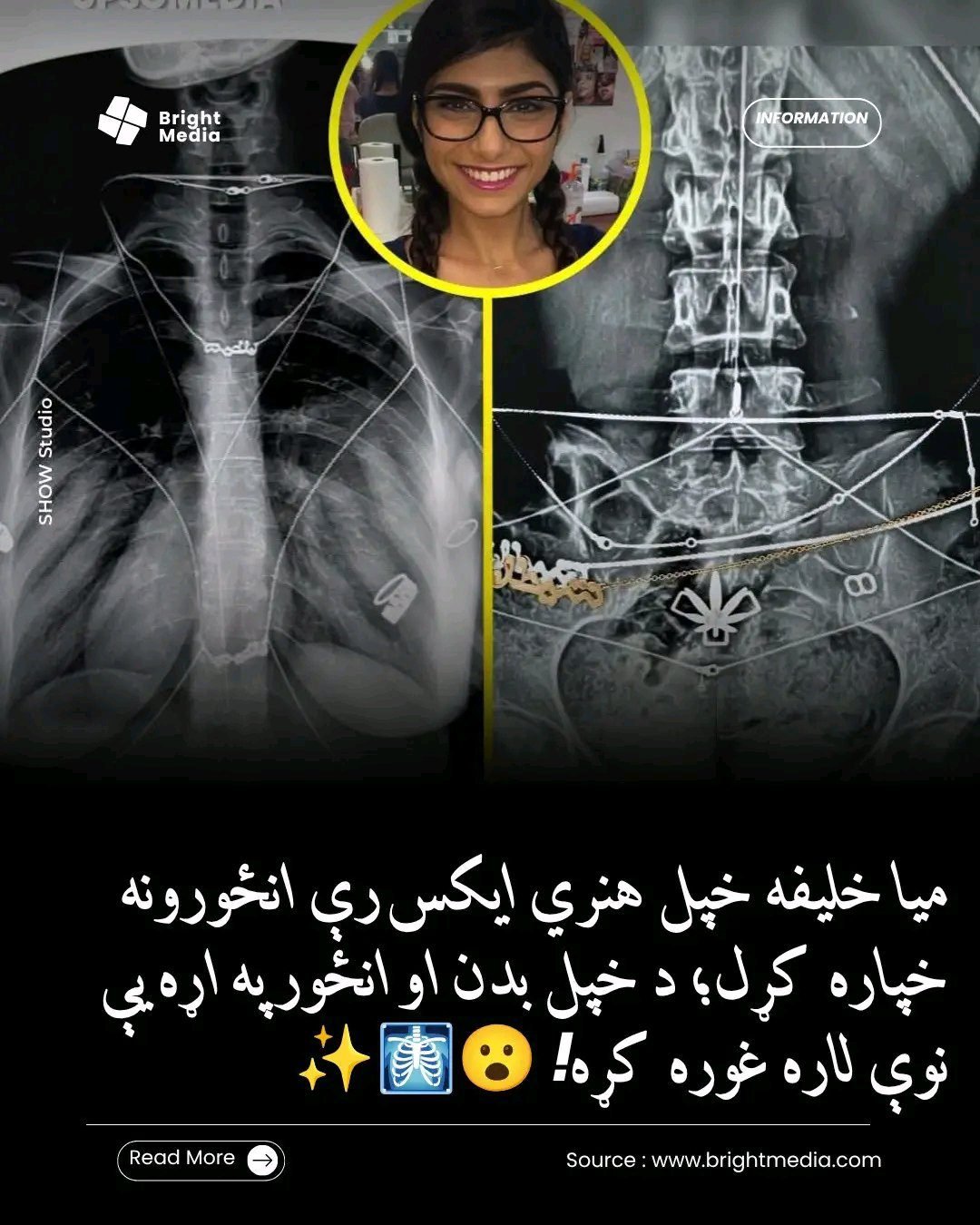 ریس خادیم