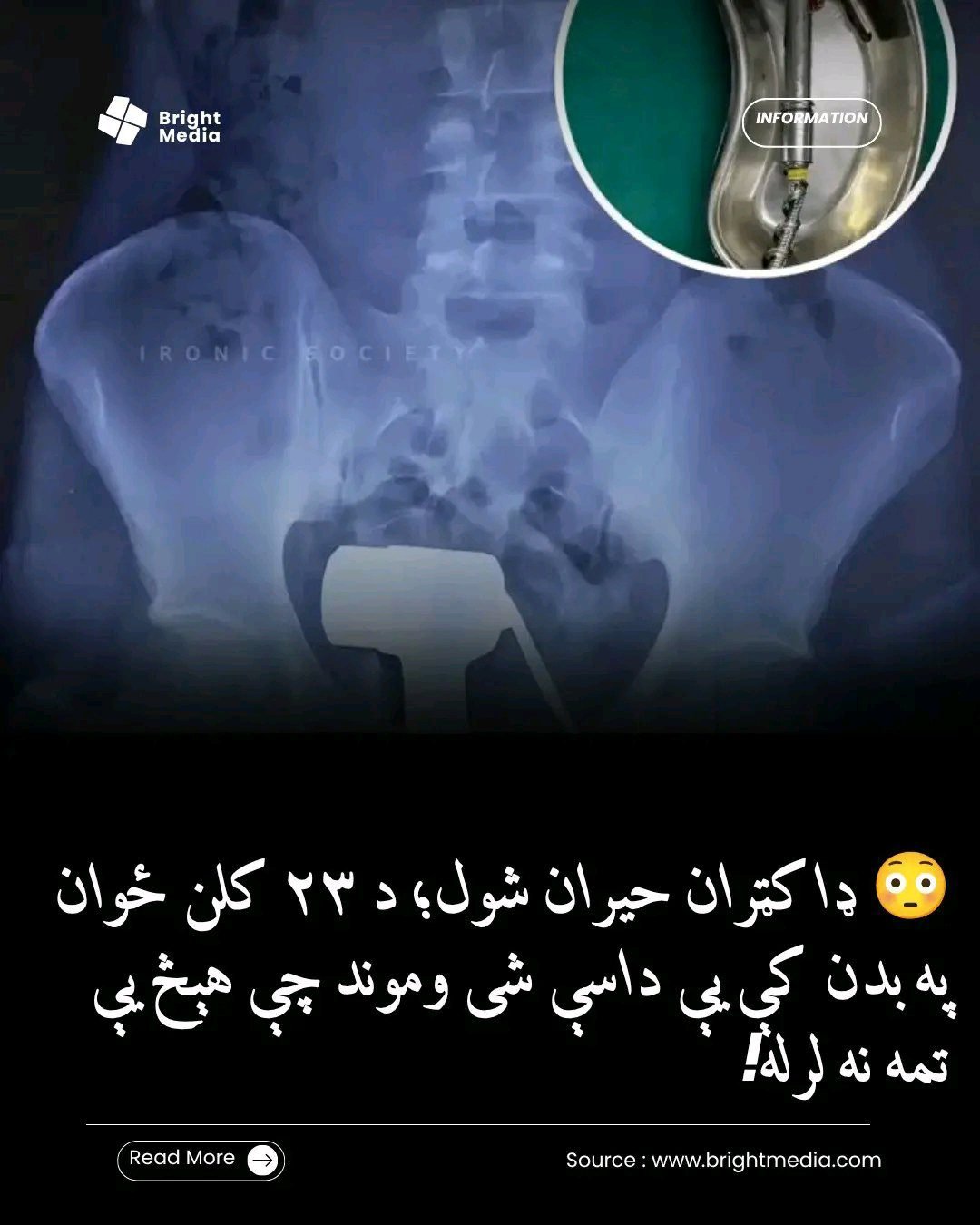ریس خادیم