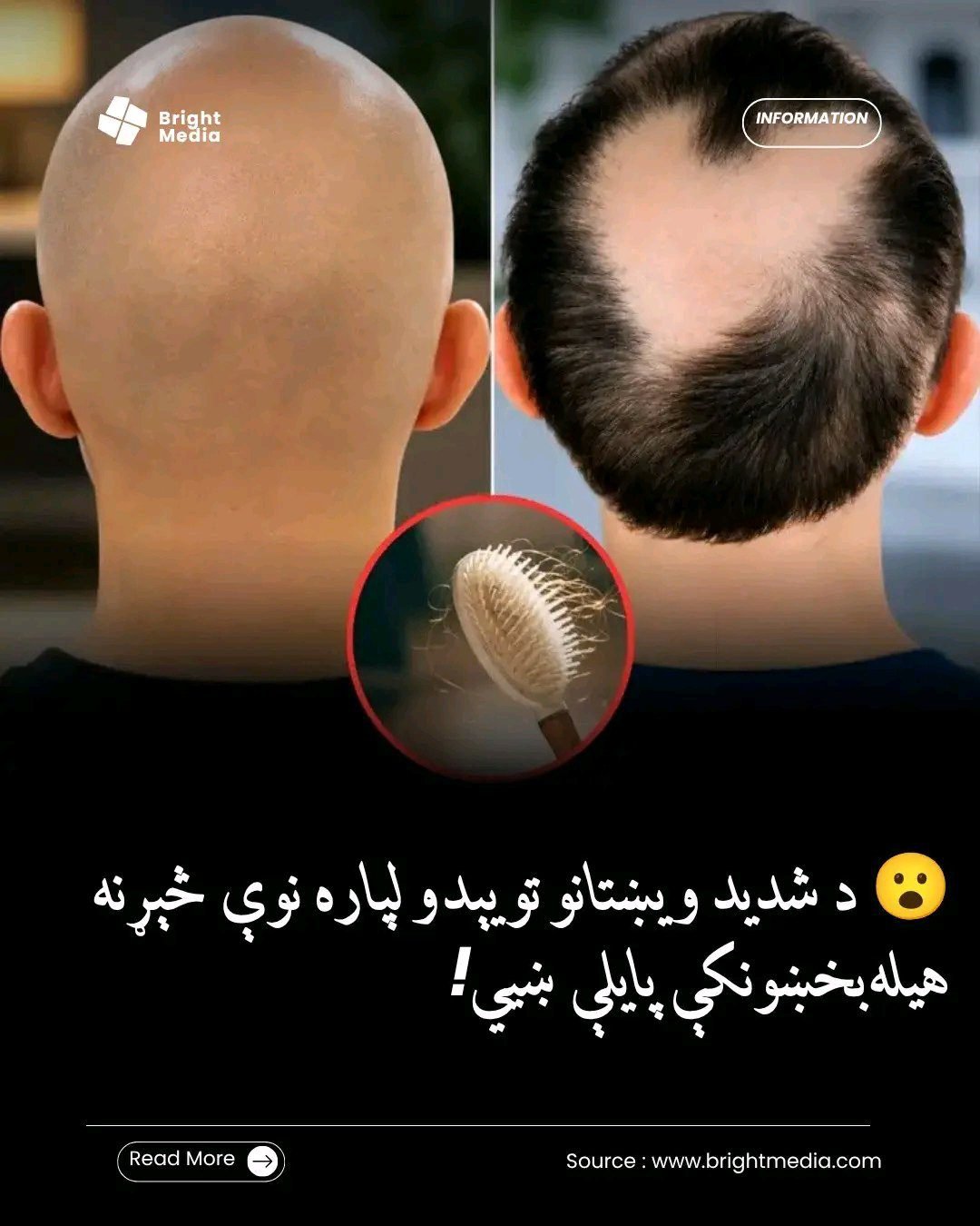 ریس خادیم