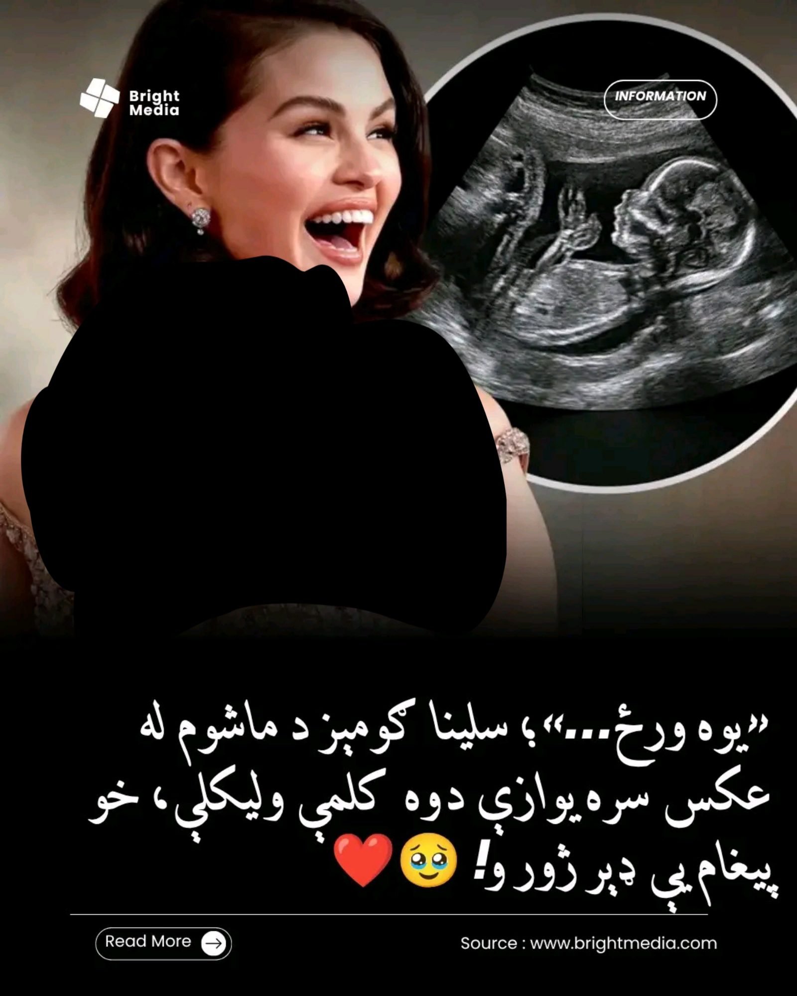 ریس خادیم