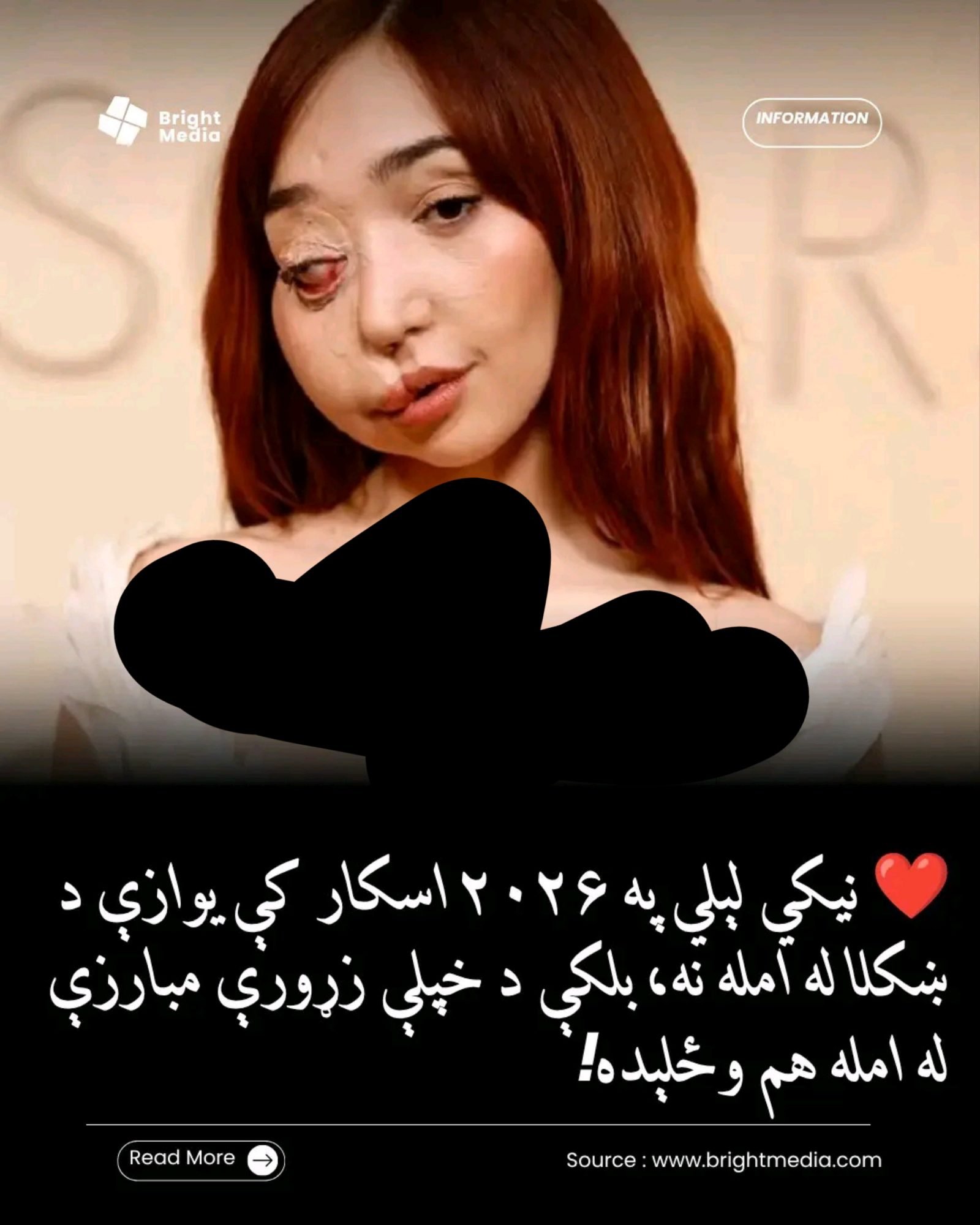 ریس خادیم