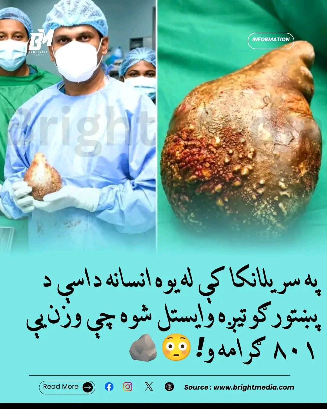 ریس خادیم