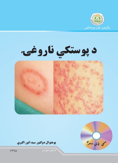 د پوستکي ناروغۍ