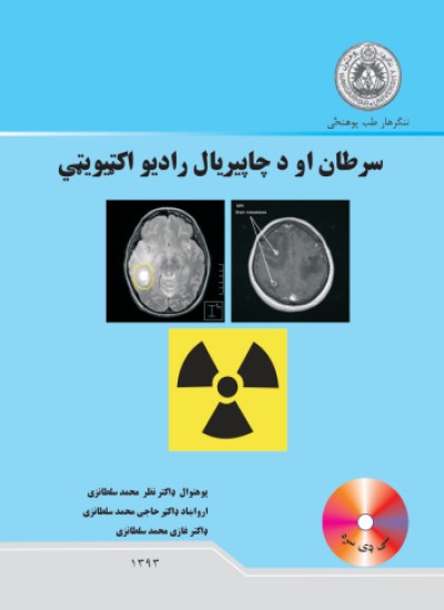 سرطان او د چاپیریال رادیو اکټیویټي