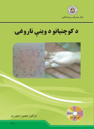 د کوچنیانو د وینې ناروغۍ