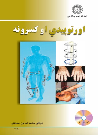 اورتوپیدي او کسرونه