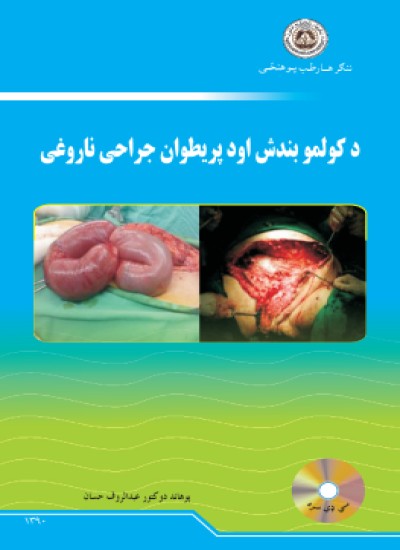 د کولمو بندش او د پریطوان جراحی ناروغی