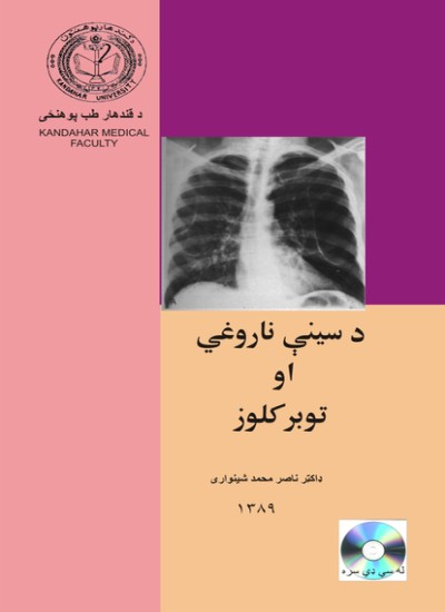 د سینې ناروغي او توبرکلوز